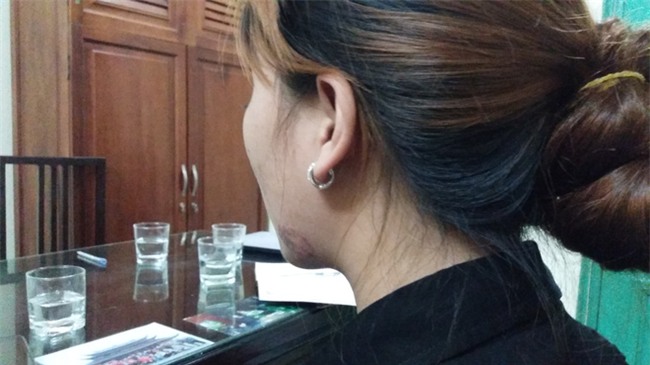 Vụ cô gái bị lột áo trên phố Hàng Mã: Tôi ân hận vì để xảy ra xô xát - Ảnh 1.