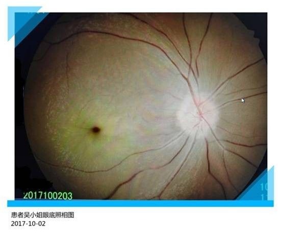 Cắm mặt cày game điện thoại suốt một ngày, cô gái trẻ không ngờ bị mù luôn một mắt - Ảnh 1.