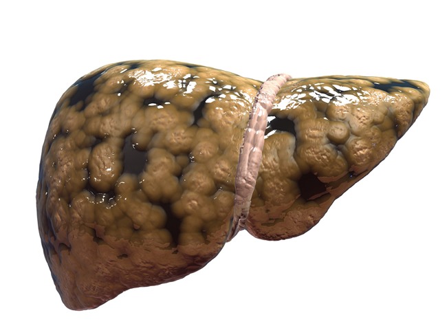 Phát hiện sốc: Thường xuyên ăn kem, uống nước có ga, trẻ dễ mắc căn bệnh nguy hiểm cho gan - Ảnh 2.