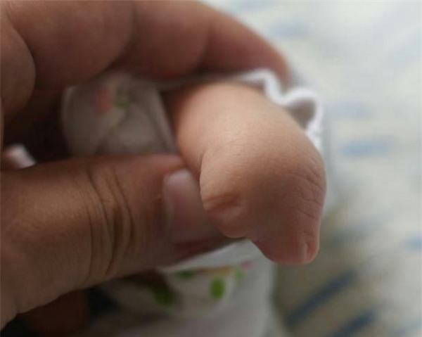 con sinh ra khong co ngon tay, biet nguyen nhan me om dau hoi han - 2