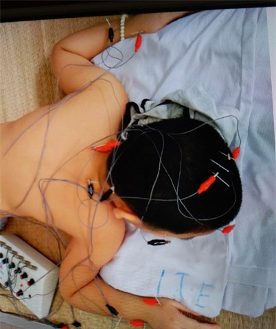 be trai 8 tuoi o ha noi mac benh la: cu ngoc dau len la ngat xiu - 4