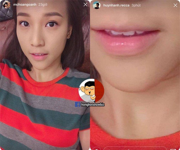 Chia tay gần nửa năm, Huỳnh Anh vẫn đăng ảnh môi Hoàng Oanh lên Instagram - Ảnh 1.