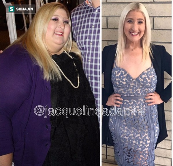 Đằng sau cô gái có đôi chân dị dạng là câu chuyện mà ai cũng thấy mình trong đó - Ảnh 1.