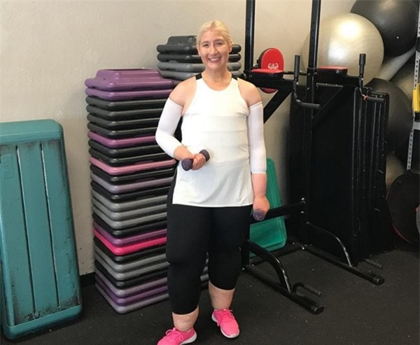 Đằng sau cô gái có đôi chân dị dạng là câu chuyện mà ai cũng thấy mình trong đó - Ảnh 3.