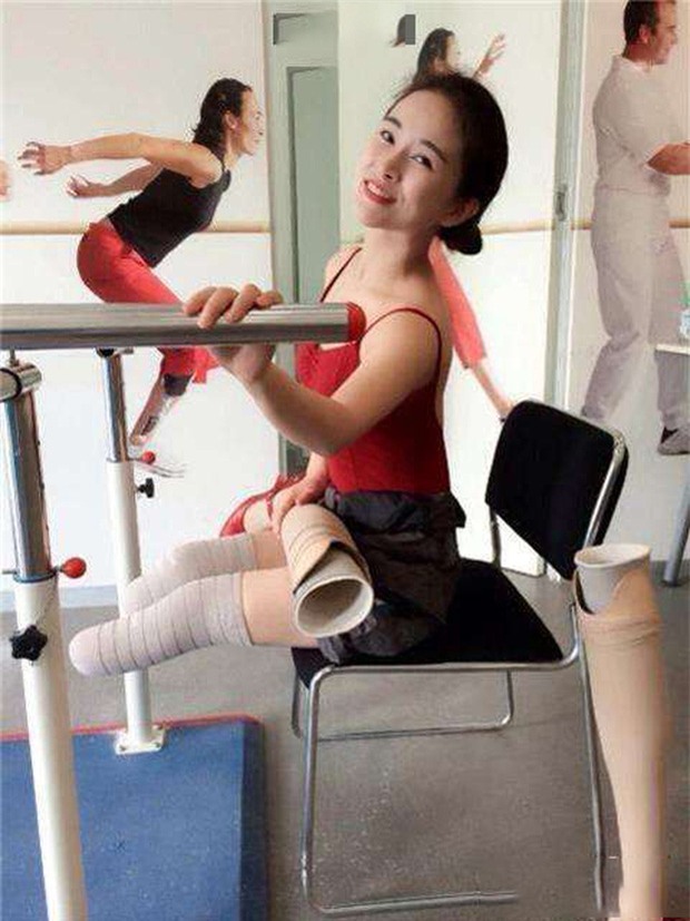 Cuộc đời đầy bão giông của vũ công xinh đẹp: Mất con, mất cả đôi chân rồi còn bị chồng bỏ rơi-9