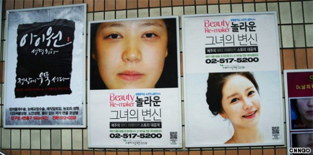 Sang Hàn Quốc thẩm mỹ, 3 nữ nhân mặt sưng, môi thâm bị chặn ở sân bay vì dung nhan khác xa ảnh hộ chiếu - Ảnh 2.
