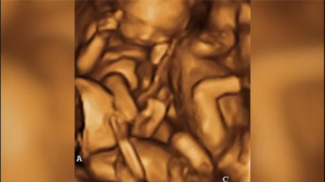 “Chửa trâu” 10 tháng chưa đẻ, gia đình bàng hoàng khi phát hiện bí mật đen tối của cô con gái tuổi teen - Ảnh 4.