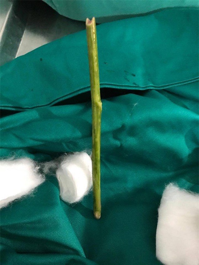 co gai tre nguy kich vi tu pha thai tai nha va dat que vao am dao de cam mau - 1