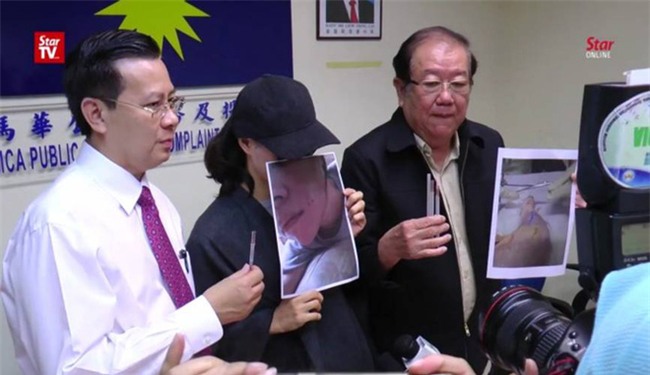 Bỏ ra hàng nghìn đô để phẫu thuật căng da mặt bằng chỉ vàng, người phụ nữ không ngờ tiền mất tật mang - Ảnh 4.