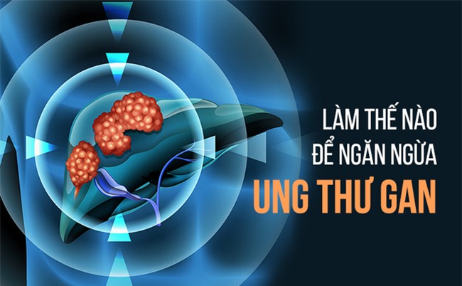 Giáo sư đầu ngành chia sẻ 6 bí quyết chăm sóc gan: Đừng để ung thư