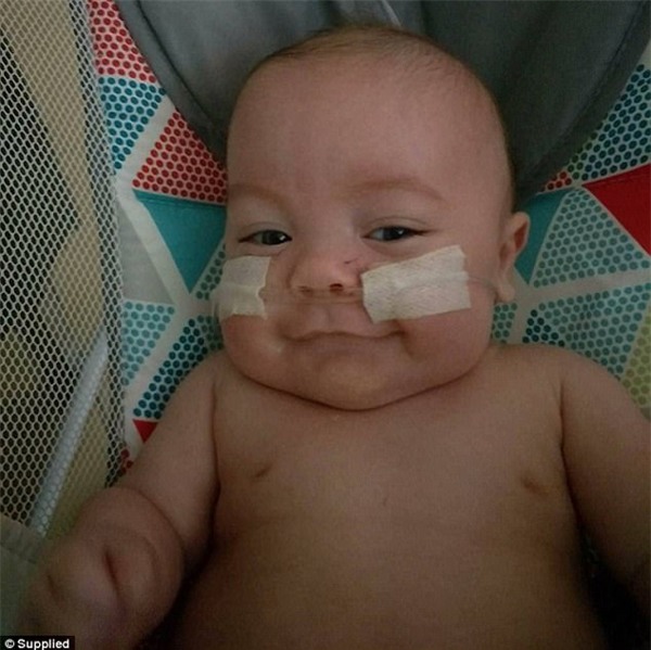 cap sinh non 4 thang, bac si noi ve lo hau su nhung ket qua that khong ngo - 6