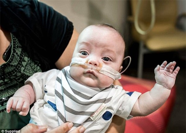 cap sinh non 4 thang, bac si noi ve lo hau su nhung ket qua that khong ngo - 7