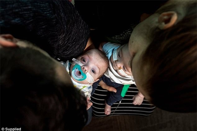 cap sinh non 4 thang, bac si noi ve lo hau su nhung ket qua that khong ngo - 8