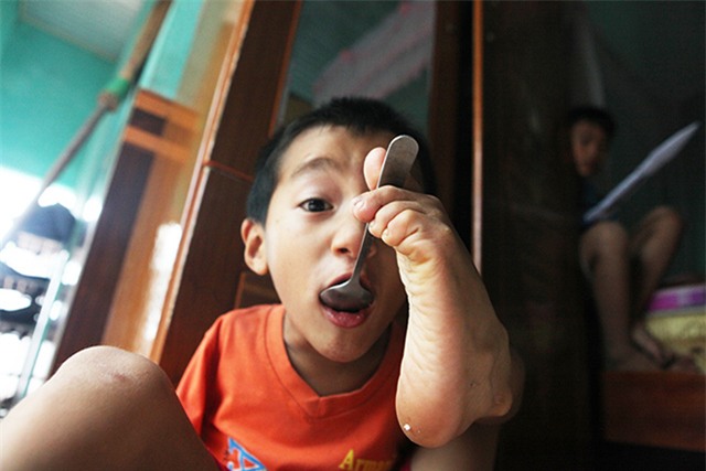 doi chan dieu ki cua cau be 7 tuoi khong tay - 12