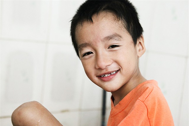 doi chan dieu ki cua cau be 7 tuoi khong tay - 15