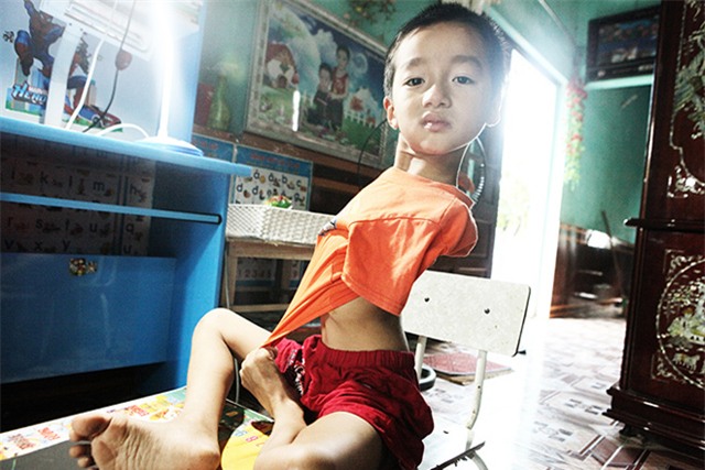 doi chan dieu ki cua cau be 7 tuoi khong tay - 3