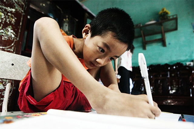 doi chan dieu ki cua cau be 7 tuoi khong tay - 8