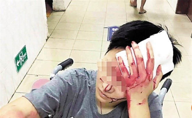 Phàn nàn về dịch vụ giao hàng, thực khách Trung Quốc bị hành hung chảy máu đầu - Ảnh 1.