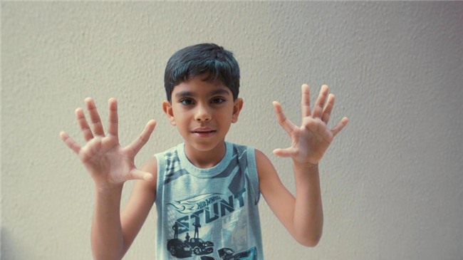 ki la: gia dinh ca 14 nguoi deu co 24 ngon tay, chan - 2