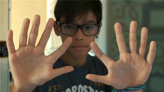 ki la: gia dinh ca 14 nguoi deu co 24 ngon tay, chan - 3