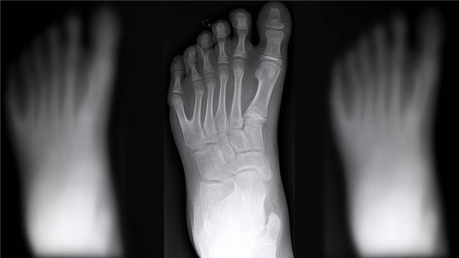 ki la: gia dinh ca 14 nguoi deu co 24 ngon tay, chan - 7