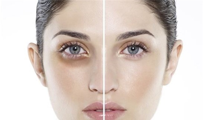 ban boi roi vi quang tham mat, vay hay xem chung xuat hien nhu the nao? - 2