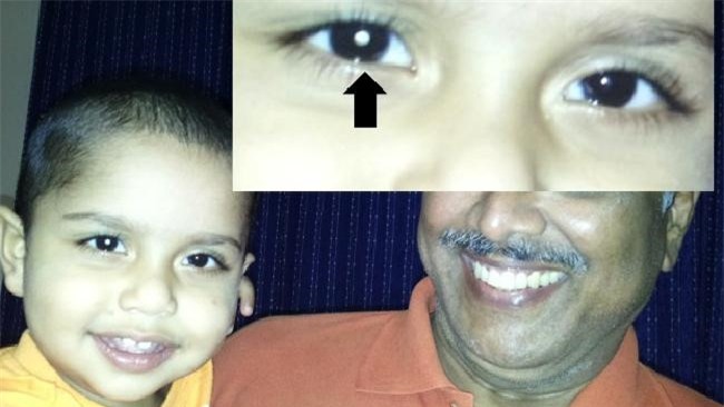 Chup anh cho con phat hien benh ung thu hiem gap hinh anh 1