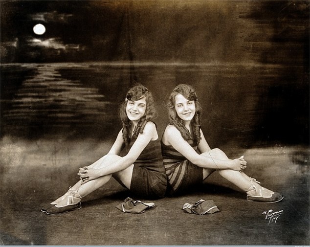 Cặp song sinh liền thân xinh đẹp nhất thế giới, kết hôn với hai ông chồng nhưng đến chết vẫn cô quạnh - Ảnh 1.