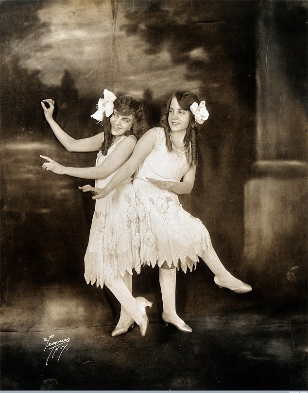 Cặp song sinh liền thân xinh đẹp nhất thế giới, kết hôn với hai ông chồng nhưng đến chết vẫn cô quạnh - Ảnh 4.