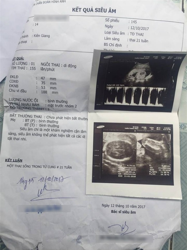 be gai 14 tuoi bi hang xom xam hai den mang thai, phai nghi hoc cho sinh con - 4