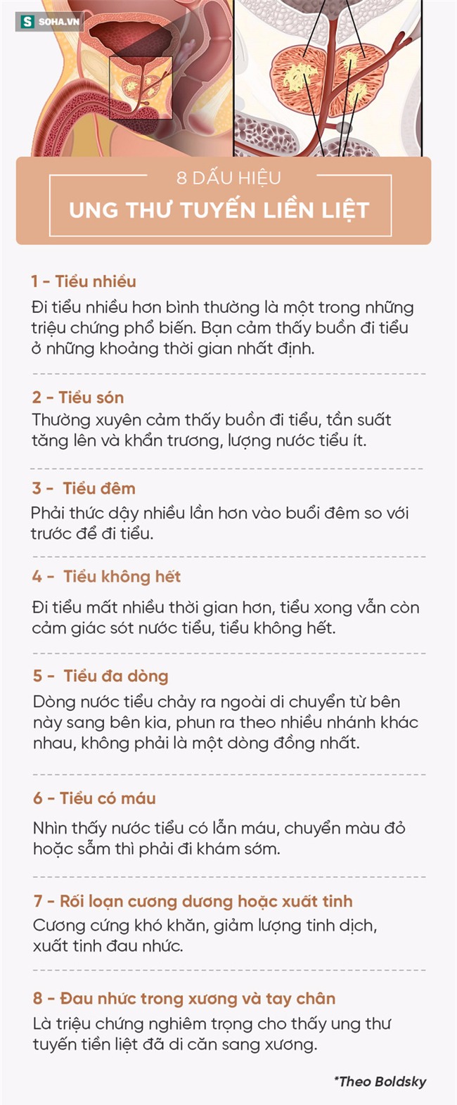 [Đọc nhanh] 8 dấu hiệu cảnh báo ung thư tuyến tiền liệt, mọi quý ông đều nên đề phòng - Ảnh 2.
