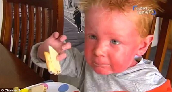 be trai co lan da do ung, di dau nguoi la cung nghi bi bo me bao hanh - 1