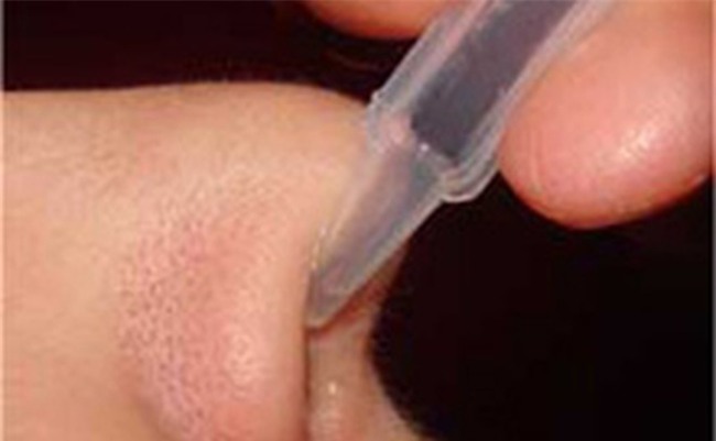 Tác hại của việc lạm dụng thuốc nhỏ mũi