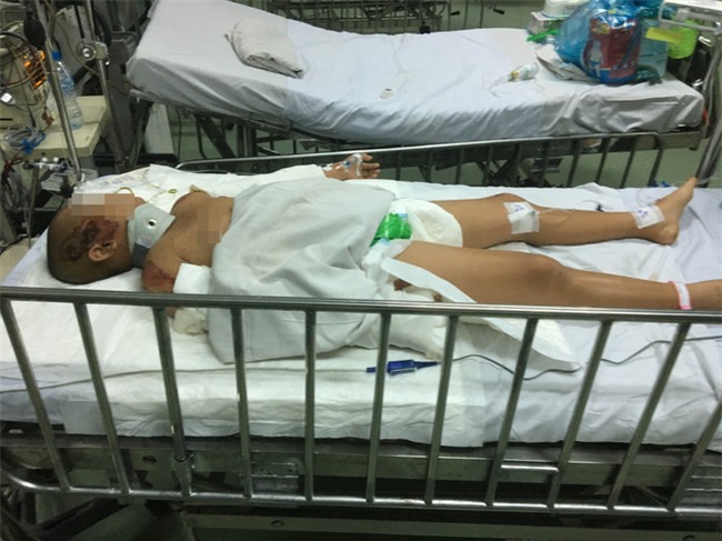 Tai nạn đau lòng: Tránh chó chạy rông, gia đình 4 người thương vong dưới bánh xe tải - Ảnh 7.