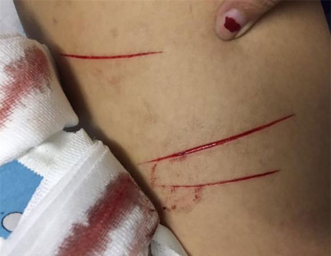 diem mat nhung ke benh hoan rach dui nu sinh gay xon xao du luan hinh anh 3