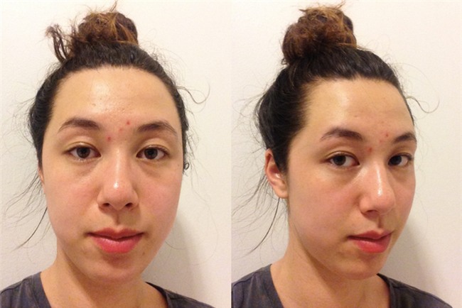 Một tuần thử nghiệm phương pháp làm sạch mặt 424 của sao Hàn và đây là kết quả - Ảnh 4.