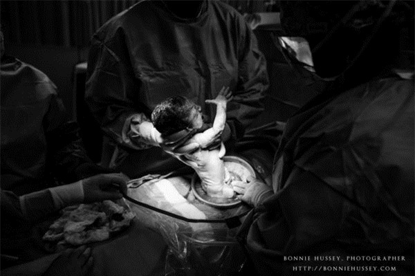 anh cham den trai tim trieu nguoi: me bi cat mot ben nguc, cao troc dau van cho con bu - 12