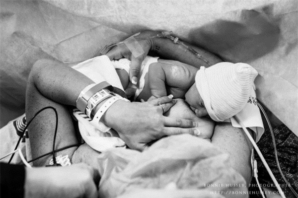 anh cham den trai tim trieu nguoi: me bi cat mot ben nguc, cao troc dau van cho con bu - 14