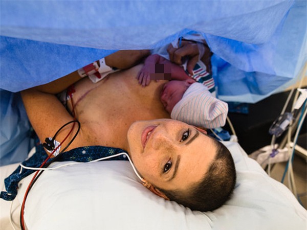 anh cham den trai tim trieu nguoi: me bi cat mot ben nguc, cao troc dau van cho con bu - 2