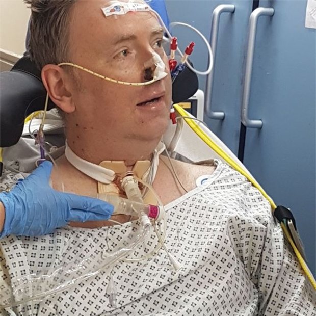 Chủ quan khi bị cảm lạnh, người đàn ông phải cắt bỏ cả tứ chi-3