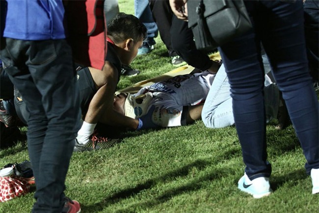 Cau thu U19 Indonesia lo ngai gay xuong co sau vu loan da hinh anh 1