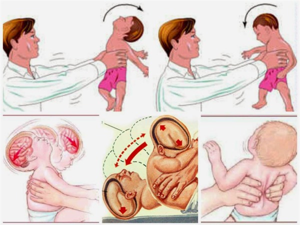 bo me dung dua, rung lac do danh, con 3 thang tuoi len con co giat, chan thuong so nao - 2