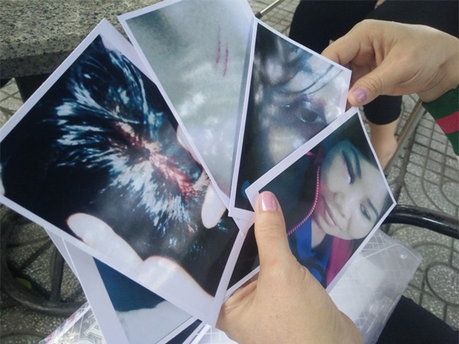 Bị người yêu của chồng kéo đến nhà đánh bầm mặt, chảy máu đầu, người phụ nữ hơn 1 năm đi kiện - Ảnh 9.