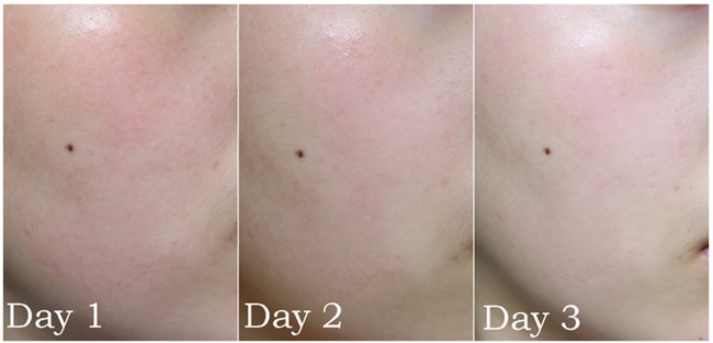 Hội mê làm đẹp nên update ngay: loại Ampoule rau má trị mụn và làm mờ thâm đang được con gái Việt thi nhau mua - Ảnh 10.