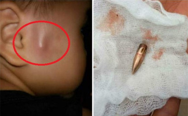 Xác định nguyên nhân ban đầu vụ đạn bay 