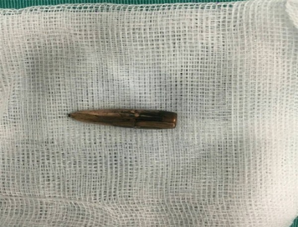 Xác định nguyên nhân ban đầu vụ đạn bay lạc ở Vĩnh Phúc - Ảnh 2.