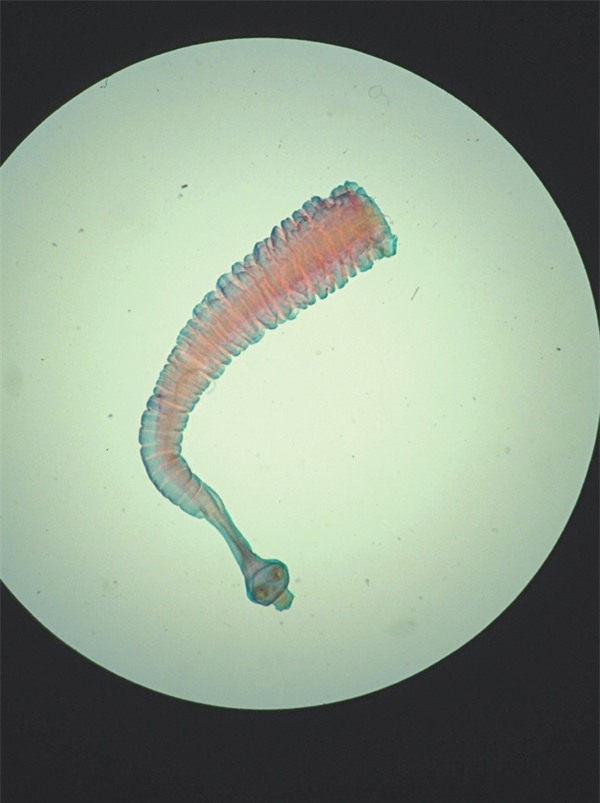 Ăn thịt bò tái, coi chừng sán dây bò! - Ảnh 1.