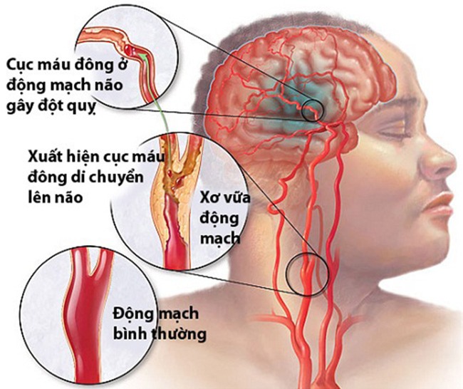 canh bao nhung cai chet do dot quy o nguoi tre - 1