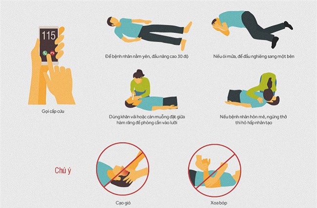 đột quỵ,tai biến mạch máu não,cấp cứu đột quỵ