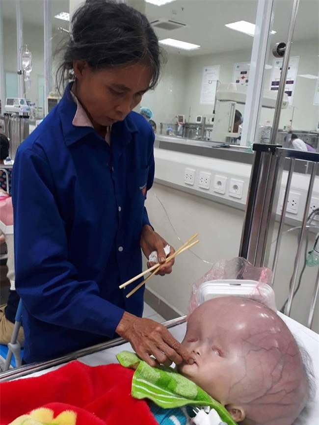 Mẹ của bé trai sinh ra có đầu to như quả bóng: Chồng và gia đình chồng đều bỏ mẹ con tôi - Ảnh 5.